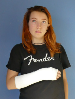 Ruth in a cast